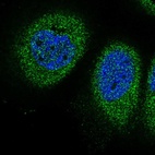 Anti-EVA1B Antibody
