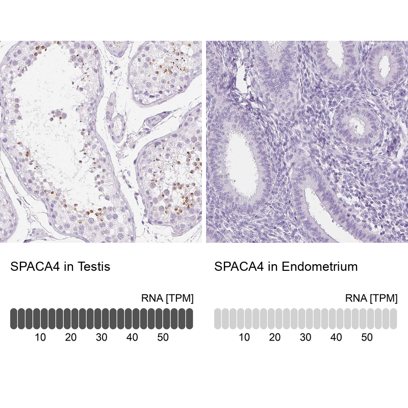 Anti-SPACA4 Antibody