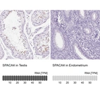 Anti-SPACA4 Antibody