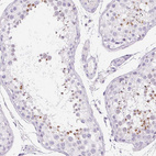 Immunohistochemical staining of human testis shows strong cytoplasmic-membranous positivity in cells in seminiferous ducts.