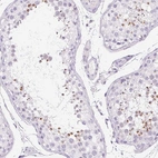 Immunohistochemical staining of human testis shows strong cytoplasmic-membranous positivity in cells in seminiferous ducts.