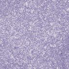 Immunohistochemical staining of human tonsil shows negative positivity in non-germinal center cells as expected.