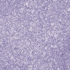 Immunohistochemical staining of human tonsil shows negative positivity in non-germinal center cells as expected.