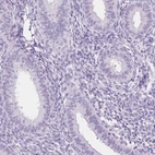 Immunohistochemical staining of human endometrium shows negative positivity in glandular cells as expected.