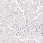 Immunohistochemical staining of human skeletal muscle shows negative positivity in myocytes as expected.