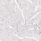 Immunohistochemical staining of human skeletal muscle shows negative positivity in myocytes as expected.