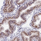 Anti-BTBD9 Antibody