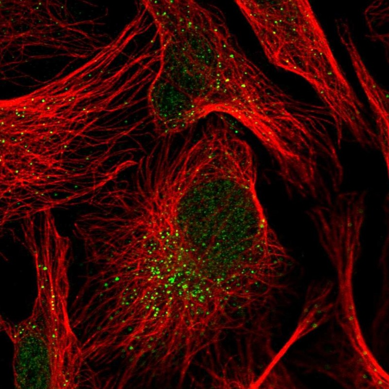 Anti-TRIP10 Antibody