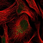 Anti-TRIP10 Antibody
