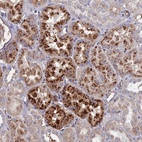 Anti-RPUSD1 Antibody