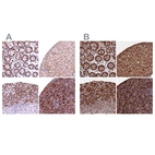 Anti-BLVRB Antibody