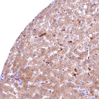 Immunohistochemical staining of human liver shows moderate to strong cytoplasmic positivity in hepatocytes.