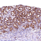 Immunohistochemical staining of human small intestine shows moderate to strong cytoplasmic positivity in glandular cells.
