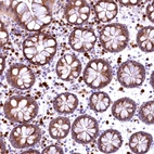 Immunohistochemical staining of human colon shows moderate to strong cytoplasmic positivity in glandular cells.