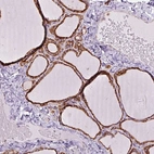 Immunohistochemical staining of human thyroid gland shows high expression.