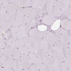 Immunohistochemical staining of human skeletal muscle shows low expression as expected.