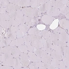 Immunohistochemical staining of human skeletal muscle shows low expression as expected.