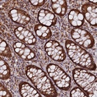 Anti-DUS3L Antibody