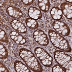 Anti-DUS3L Antibody