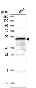 Western blot analysis in human cell line RT-4.