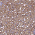 Anti-TMEM208 Antibody