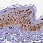Immunohistochemical staining of human skin using Anti-FAM103A1 antibody HPA041948.