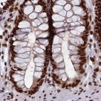 Immunohistochemical staining of human colon using Anti-FAM103A1 antibody HPA041948.