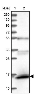 Lane 1: Marker [kDa] 250, 130, 95, 72, 55, 36, 28, 17, 10_br/_Lane 2: Human cell line RT-4
