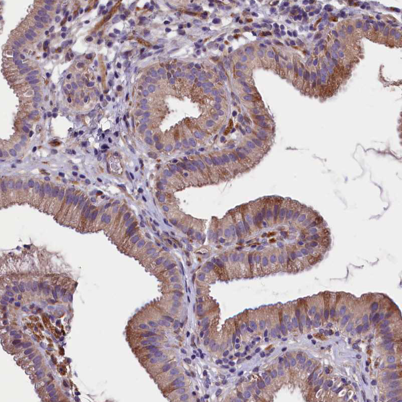 Anti-GPR108 Antibody