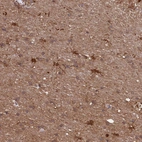 Immunohistochemical staining of human cerebral cortex shows strong cytoplasmic positivity in glial cells and neuropil.