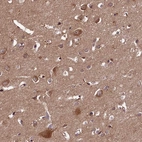Immunohistochemical staining of human cerebral cortex shows strong cytoplasmic positivity in neurons.