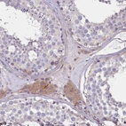 Immunohistochemical staining of human testis shows moderate cytoplasmic positivity in Leydig cells.