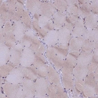 Immunohistochemical staining of human skeletal muscle shows weak cytoplasmic positivity in myocytes.