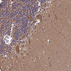 Immunohistochemical staining of human cerebellum shows strong cytoplasmic positivity in Purkinje cells.