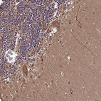 Immunohistochemical staining of human cerebellum shows strong cytoplasmic positivity in Purkinje cells.