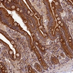 Immunohistochemical staining of human duodenum shows strong cytoplasmic positivity in glandular cells.