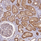 Immunohistochemical staining of human kidney shows moderate cytoplasmic positivity in cells in tubules.