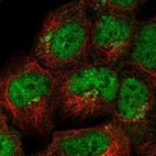 Immunofluorescent staining of human cell line HEK 293 shows localization to nucleoplasm & the Golgi apparatus.