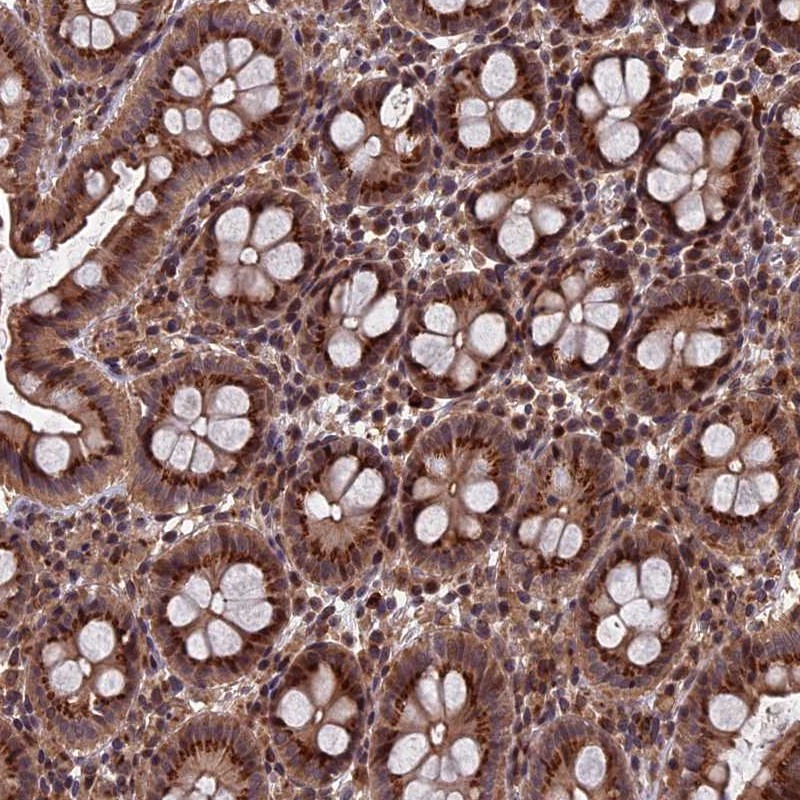 Anti-RASGRF1 Antibody