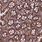 Anti-RASGRF1 Antibody
