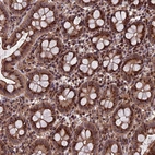 Anti-RASGRF1 Antibody