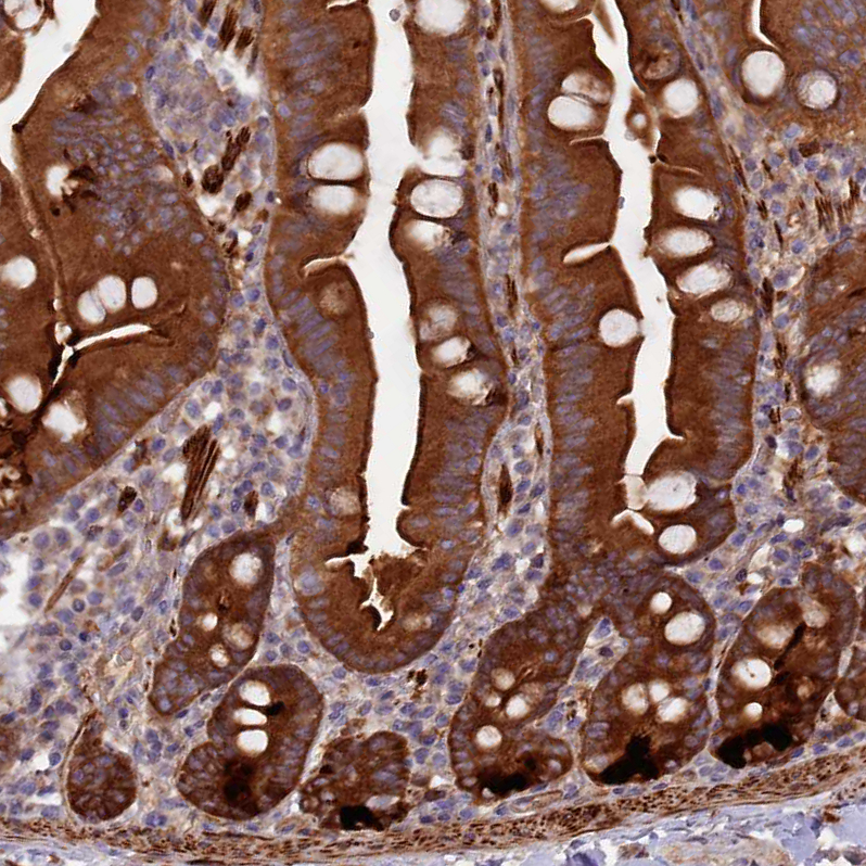 Anti-FERMT1 Antibody