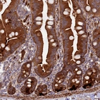 Anti-FERMT1 Antibody