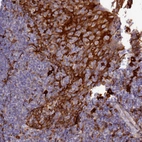 Immunohistochemical staining of human tonsil shows strong cytoplasmic positivity in squamous epithelial cells.