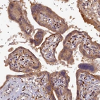 Immunohistochemical staining of human placenta shows strong cytoplasmic positivity in trophoblastic cells.