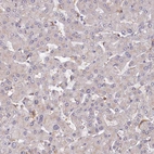 Immunohistochemical staining of human liver shows very weak cytoplasmic positivity in hepatocytes.