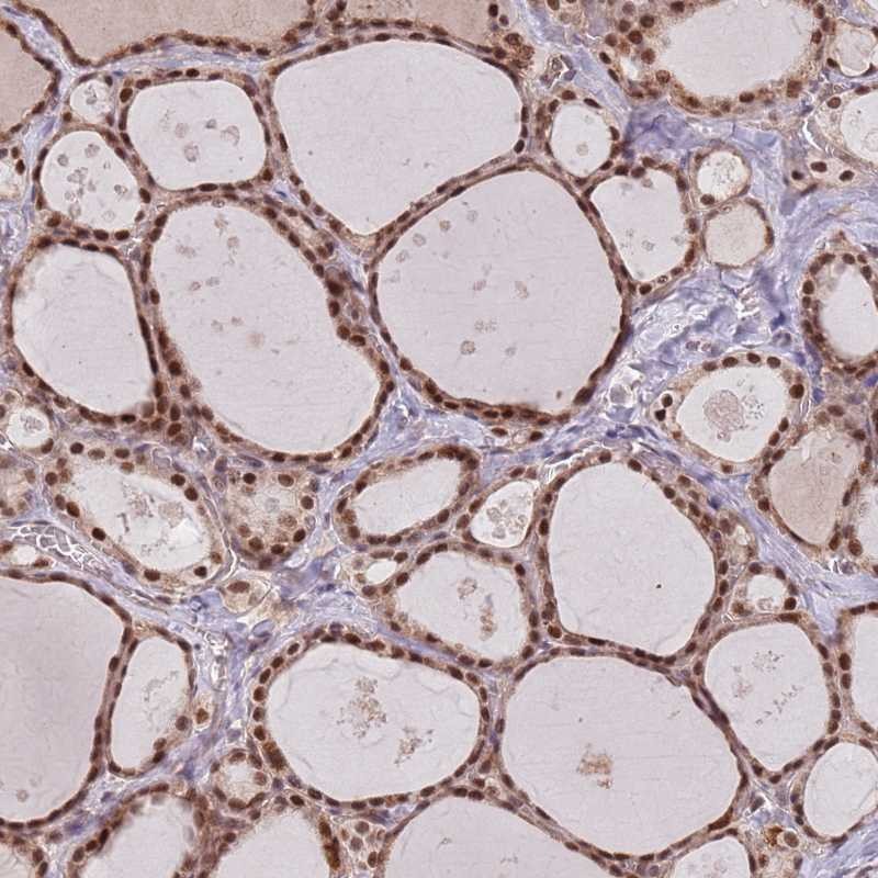 Anti-SUDS3 Antibody
