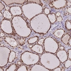 Anti-SUDS3 Antibody