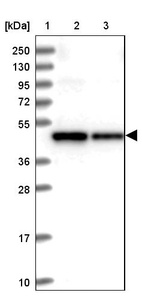 Lane 1: Marker [kDa] 250, 130, 95, 72, 55, 36, 28, 17, 10_br/_Lane 2: Human cell line RT-4_br/_Lane 3: Human cell line U-251MG sp