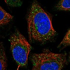 Immunofluorescent staining of human cell line SiHa shows localization to vesicles.